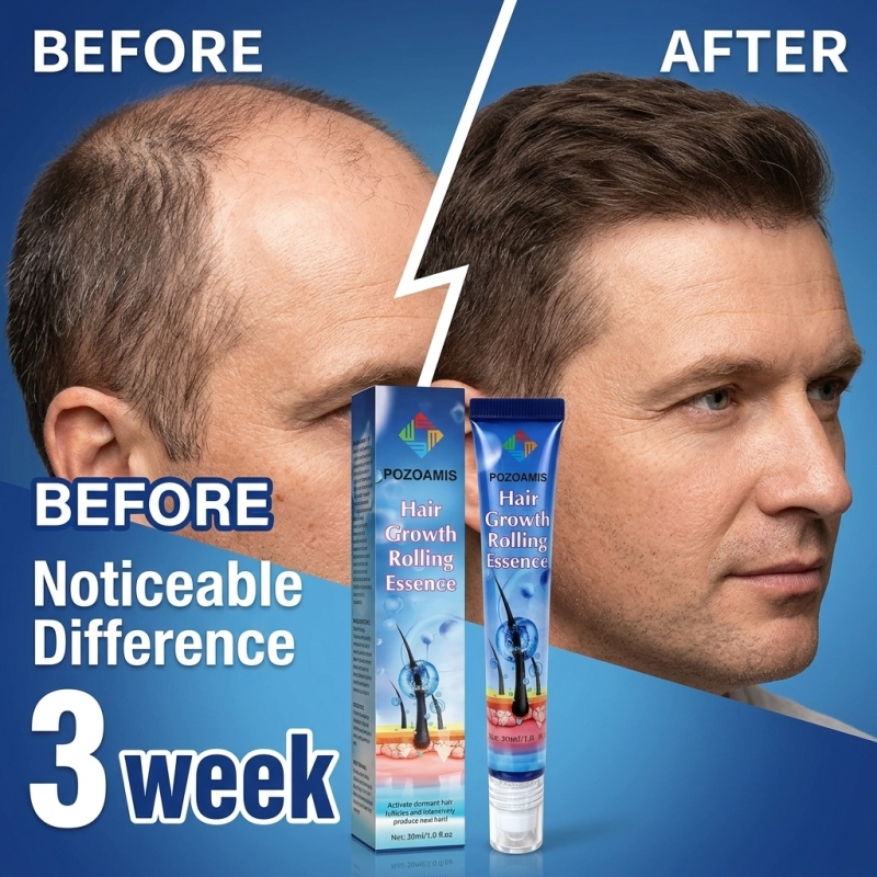 Hair Care Daily Routine - Portable Roller‑Ball Scalp Nourishing Hair Serum