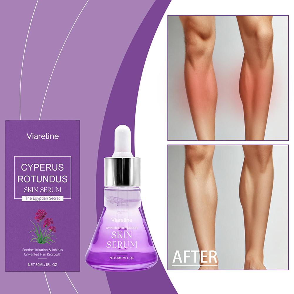 Post Hair Removal Care Serum S - Hair Care Lotion 评论和价格