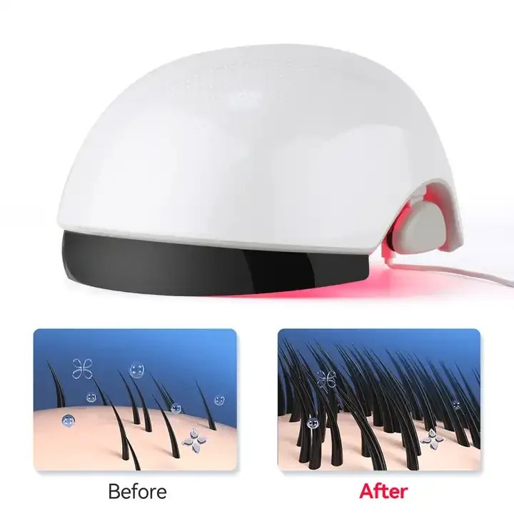 Red‑Light Hair Growth Helmet,  - Hair Care Lab 评论和价格